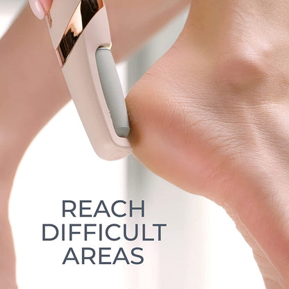Electric Foot File – Instant Callus Remover for Soft & Smooth Feet